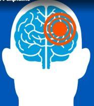 Electroencephalogram (EEG) illustration 1