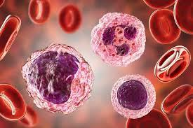 Multiple Sclerosis illustration 2