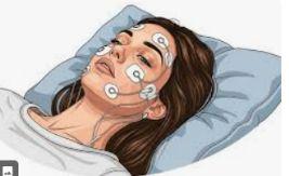 Polysomnography (Sleep Study) illustration 2