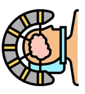 Stereotactic Neurosurgery illustration 1