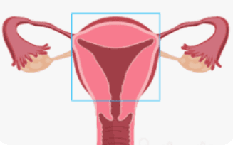 Hysterectomy & Ovarian Cancer Surgery illustration 2