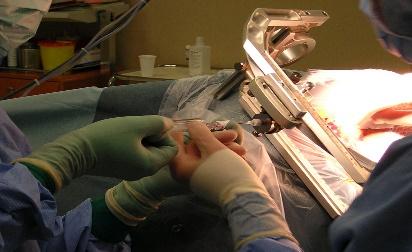 Head & Neck Cancer Surgery illustration 1