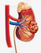 Urologic Oncology Surgery illustration 2